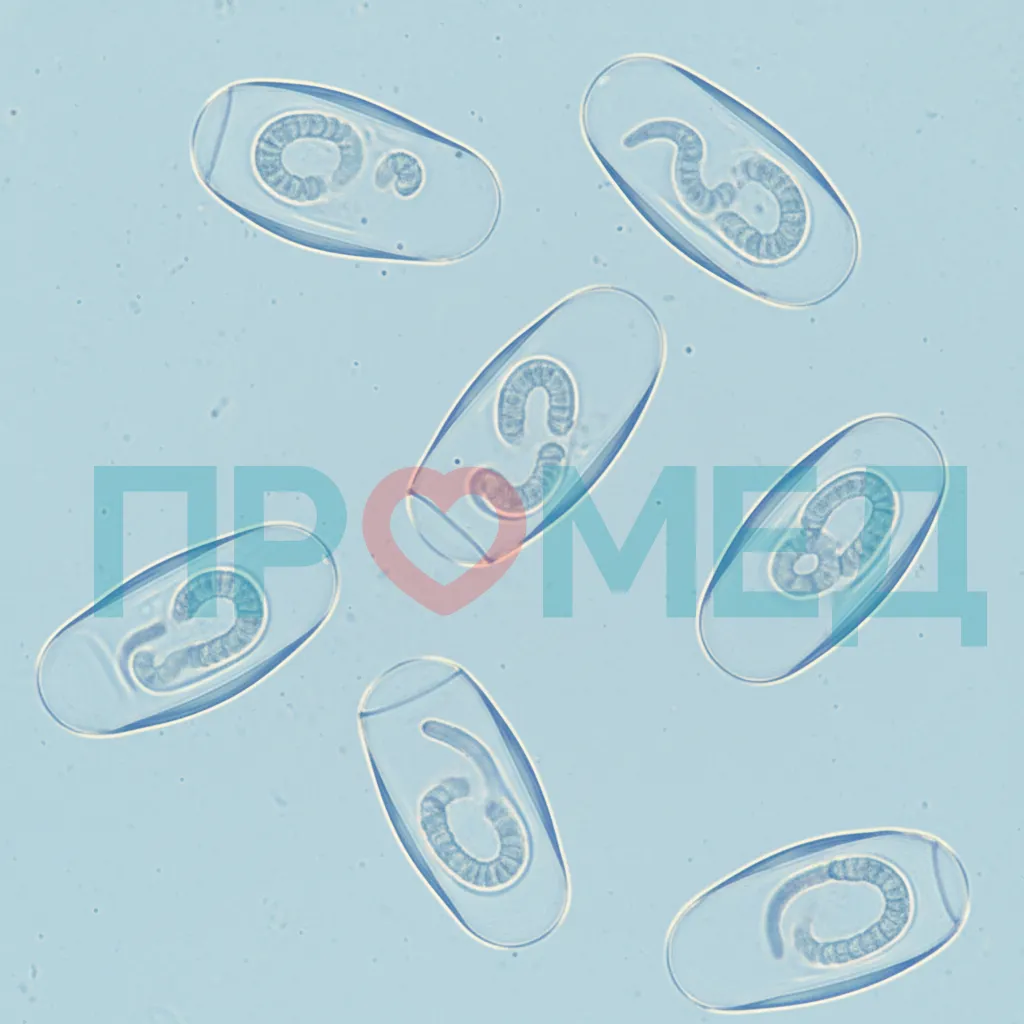Микроскопическое изображение яиц остриц (Enterobius vermicularis)