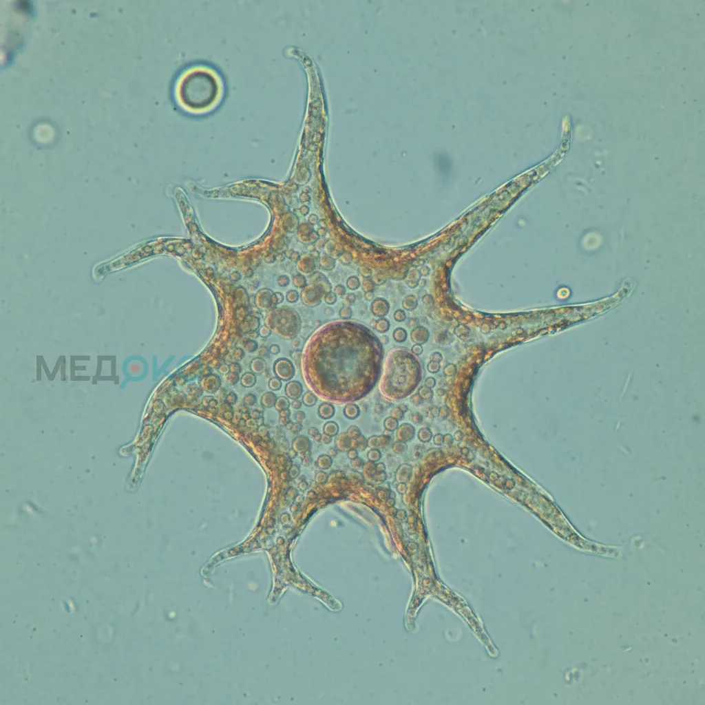 Микрофотография амёбы Naegleria fowleri